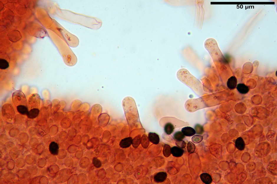 lacrymaria pyrotricha 4812 40.jpg