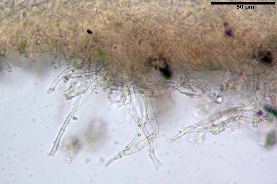 octospora roxheimii 4825 14.jpg