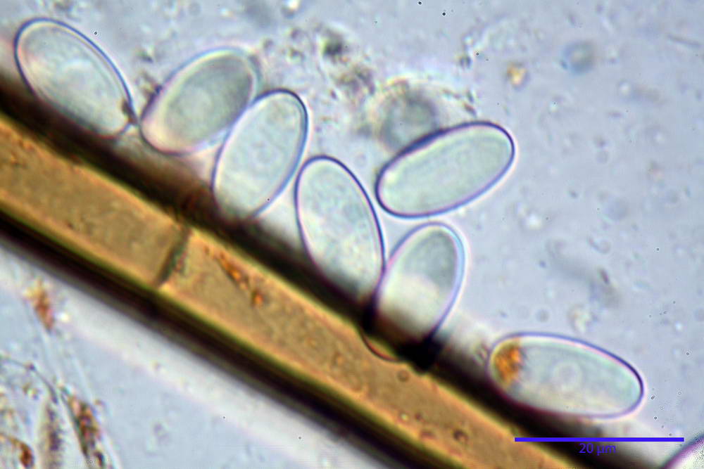 cheilimenia stercorea 4900 49.jpg