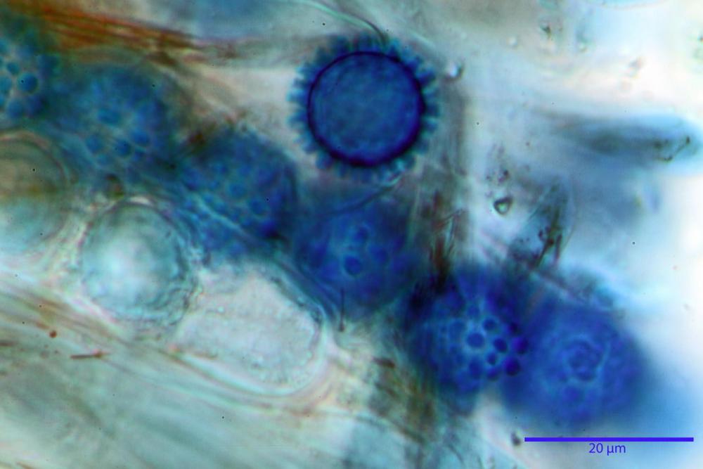 scutellinia trechispora 5343 31.jpg