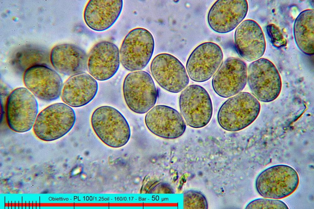 pilobolus crystallinus var kleinii spore.jpg