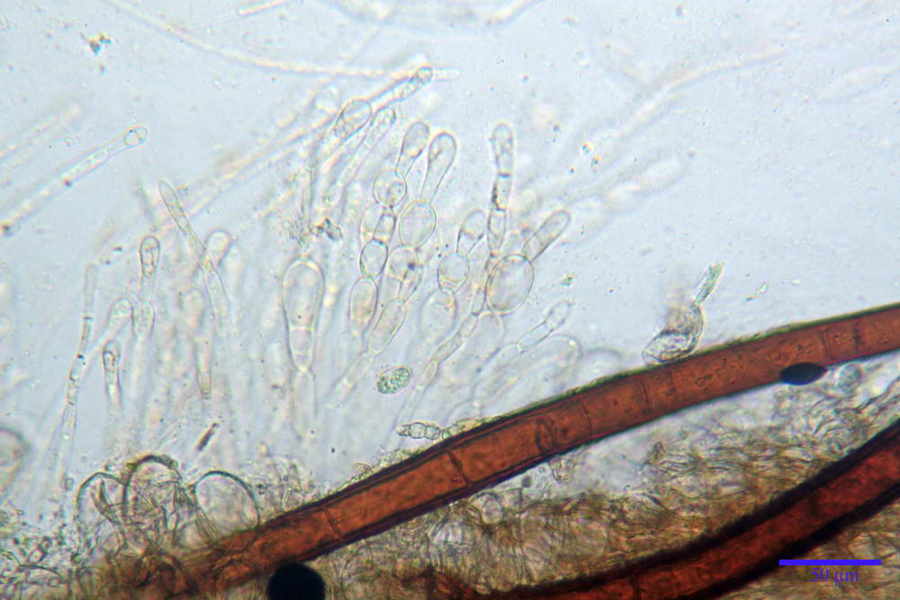 scutellinia crinita 22.jpg
