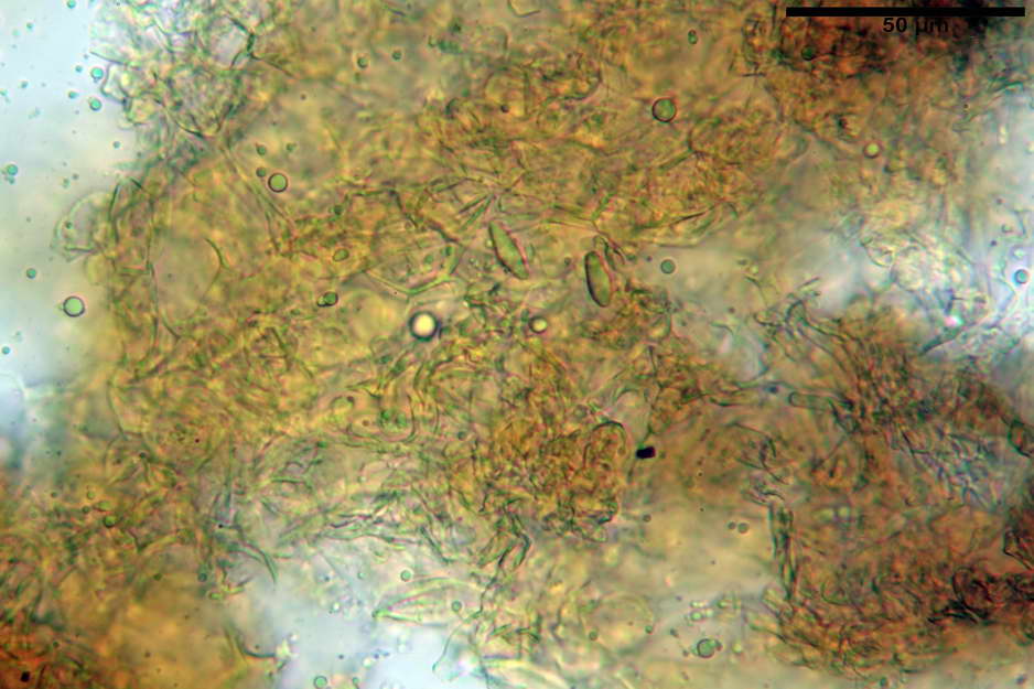 hysterangium 07.jpg