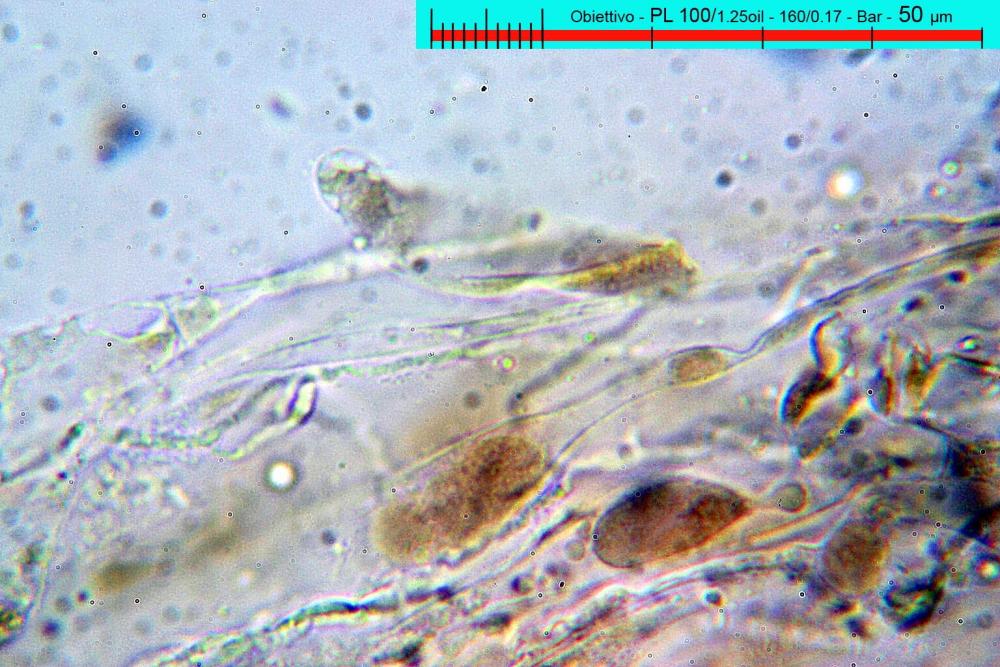 entoloma costatum pileipellis in soluzione satura zuccherina 01.jpg