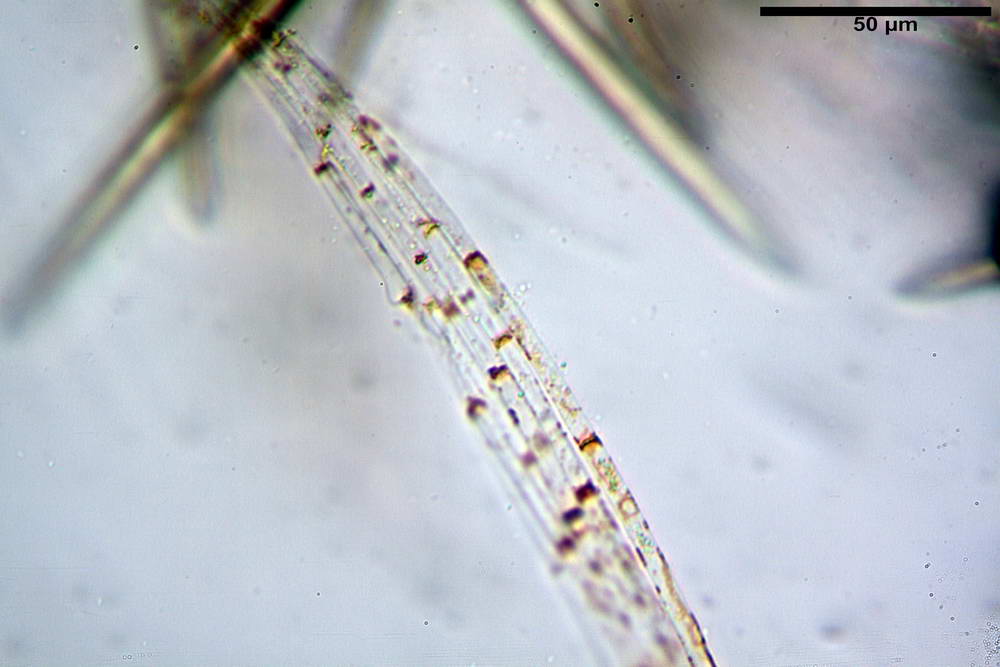 cheilimenia stercorea 4900 32.jpg