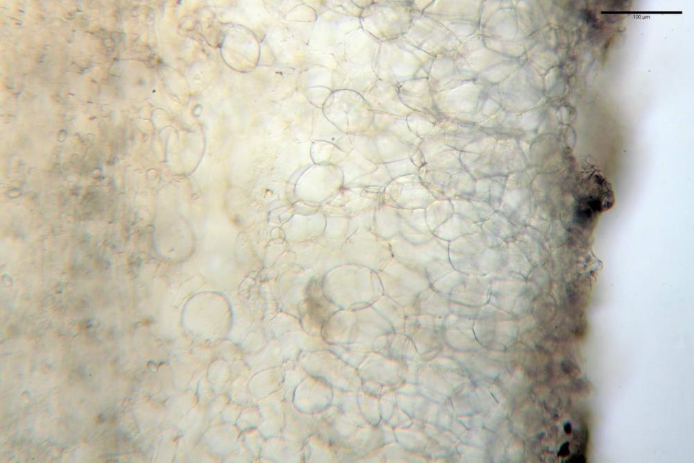 4 peziza repanda da sinistra excipulum medullare inferiore e ectale.jpg