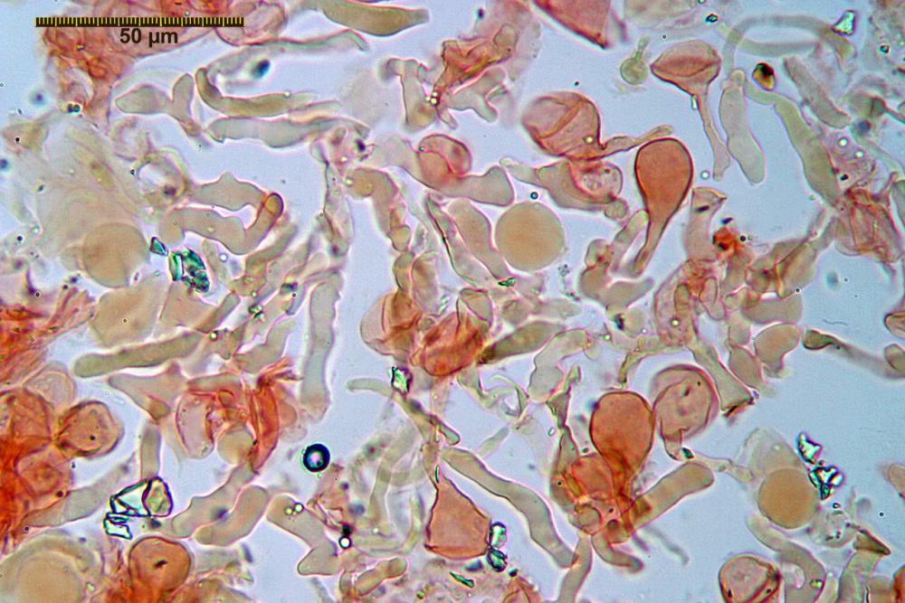 conocybe inocybeoides pileipellis e pileocistidi 90.jpg