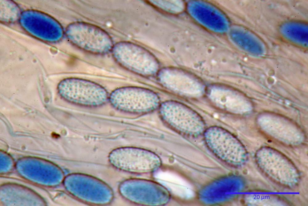 8 peziza echinospora spore blu lattico a caldo.jpg