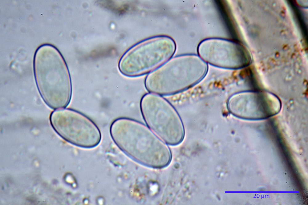 cheilimenia stercorea 4900 46.jpg