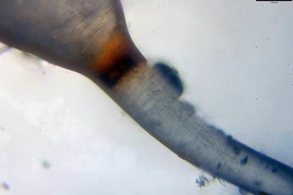 Pilobolus kleinii 9525 14.jpg