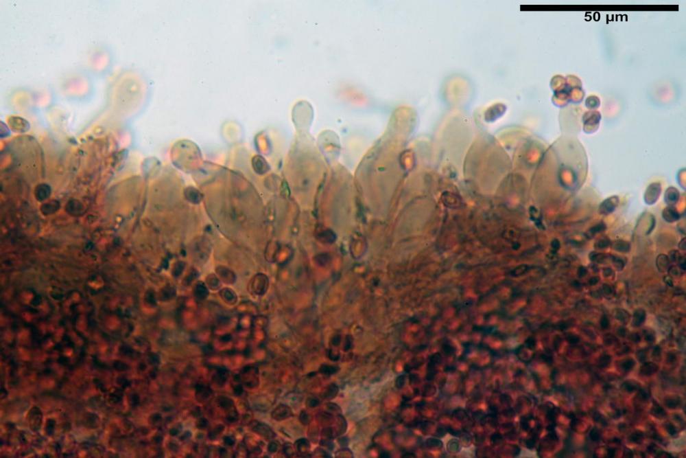 Leucoagaricus babosiae cheilocistidi.jpg