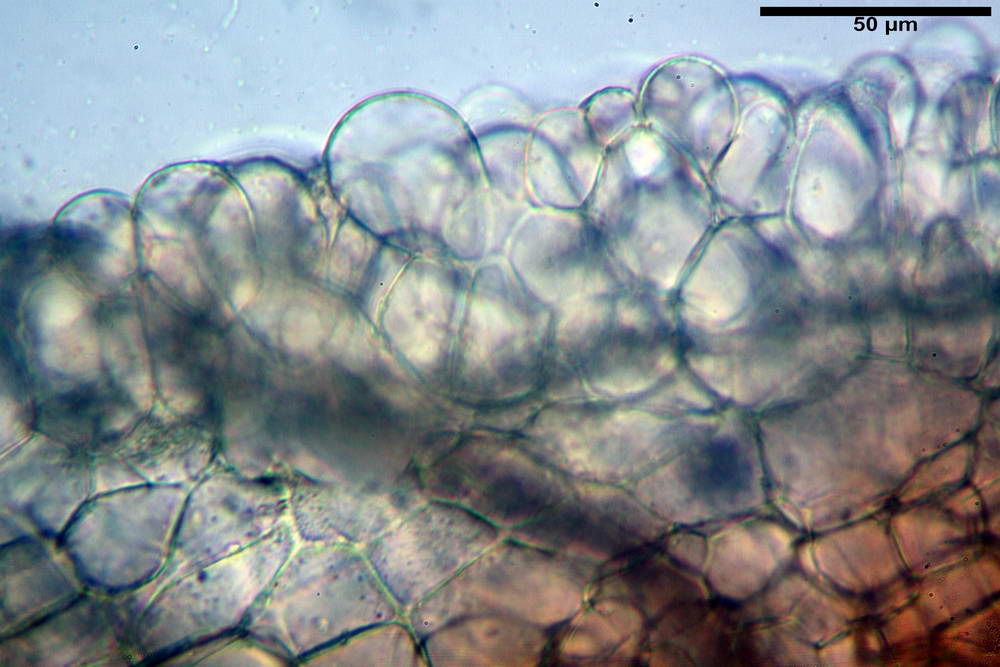 cheilimenia stercorea 4900 31.jpg