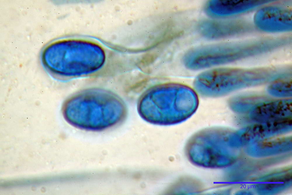 scutellinia crinita 29.jpg