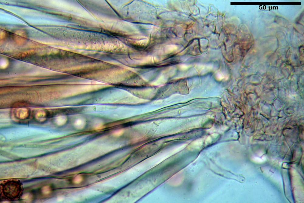 Plicaria trachycarpa 6920 19.jpg