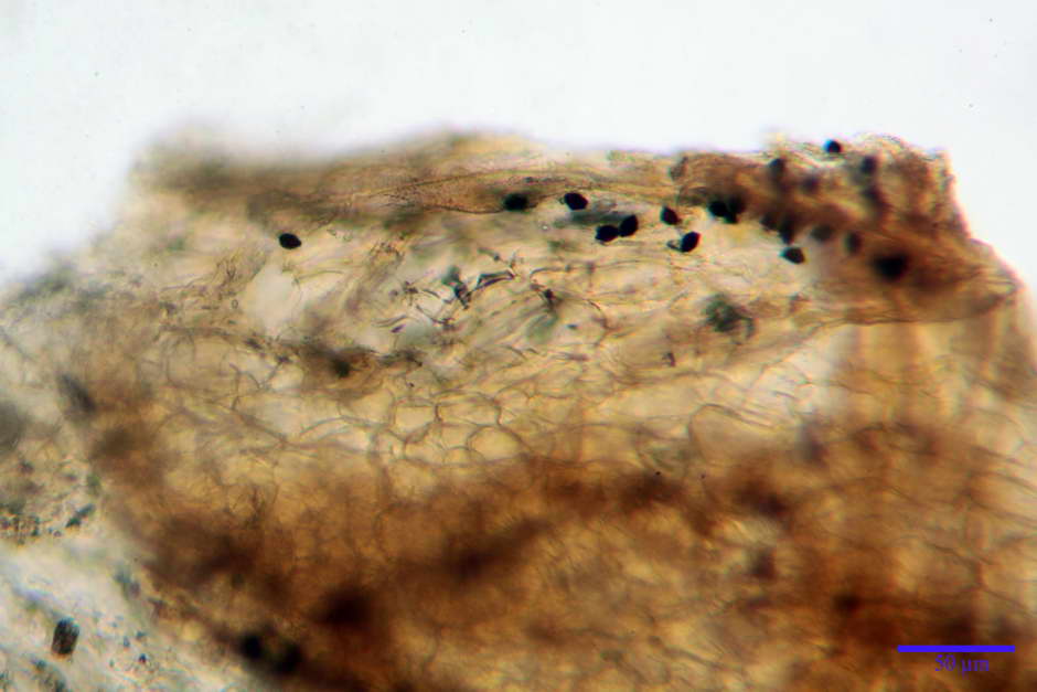 lacrymaria pyrotricha 4812 11.jpg