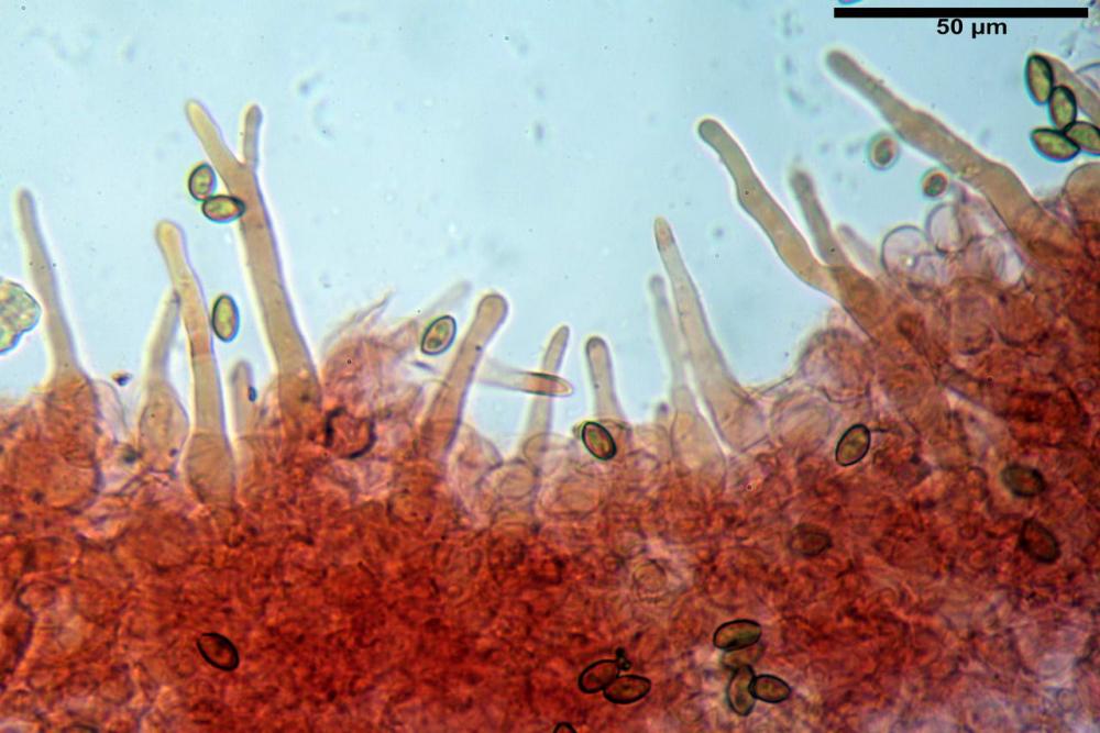 Pholiotina pygmaeoaffinis pileipellis pileocistidi.jpg