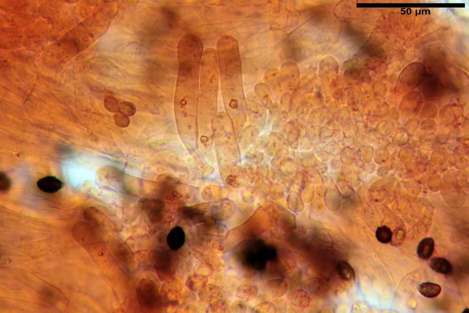 lacrymaria pyrotricha 4812 42.jpg