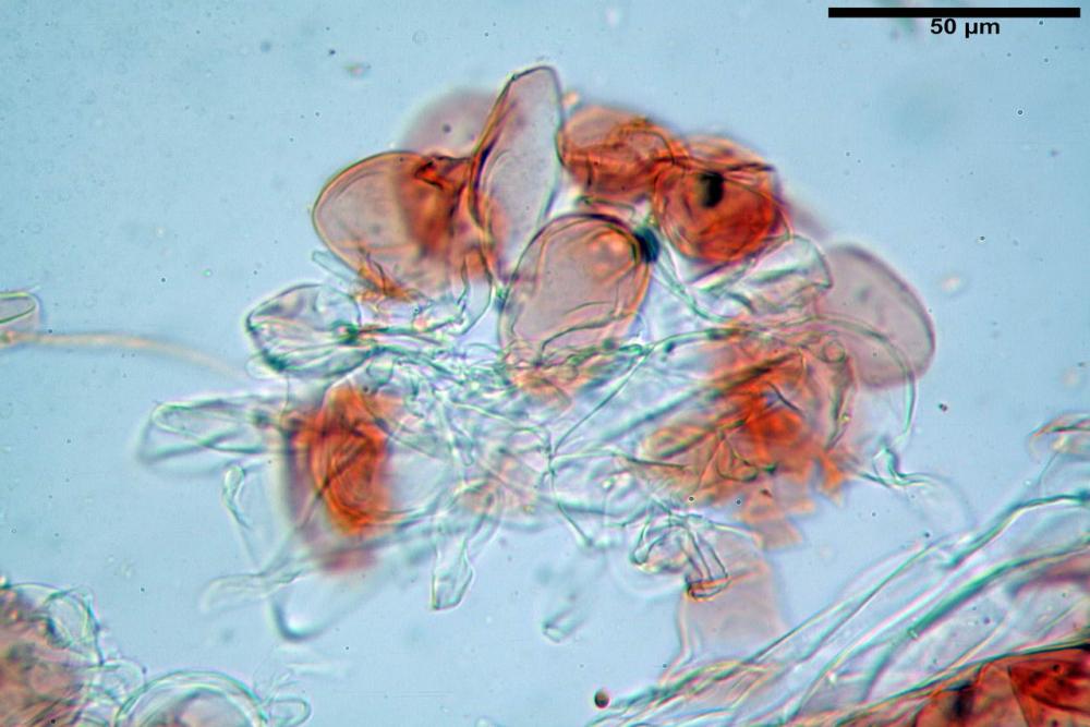 psathyrella pennata cellule pileipellis.jpg