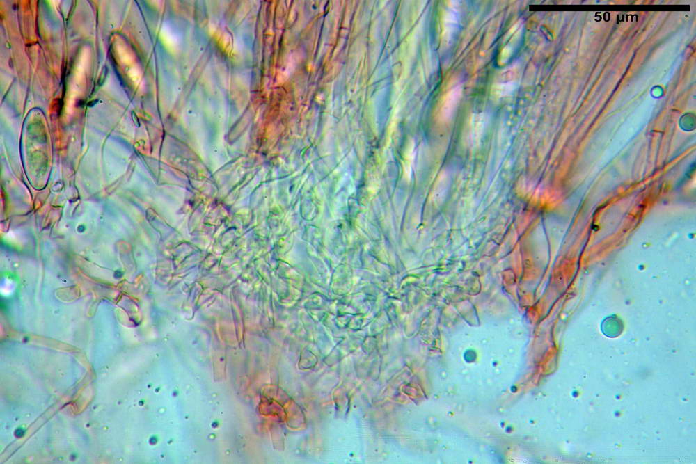 byssonectria terrestris 5043 30.jpg
