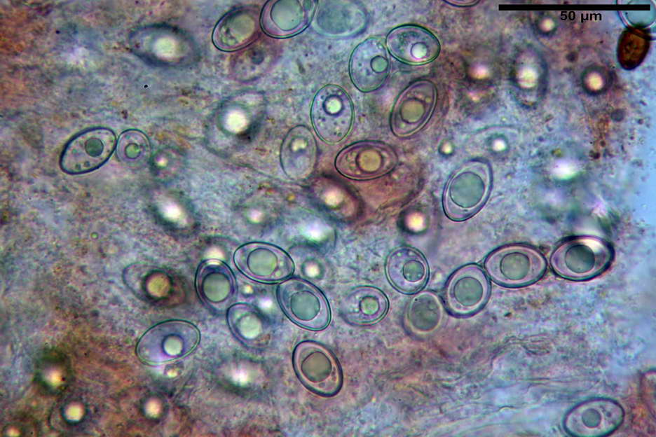 octospora roxheimii 4825 22.jpg