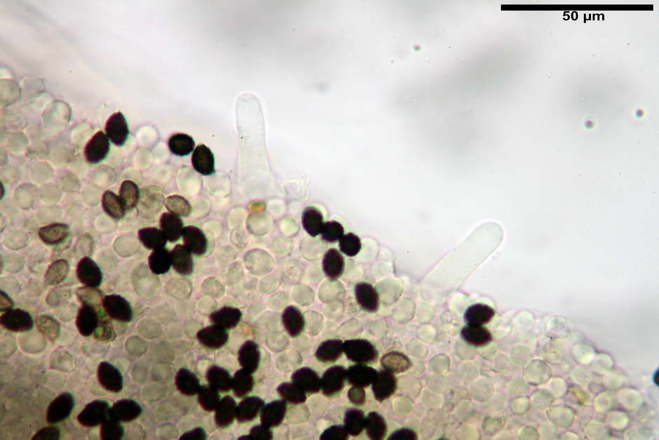 lacrymaria pyrotricha 4812 35.jpg