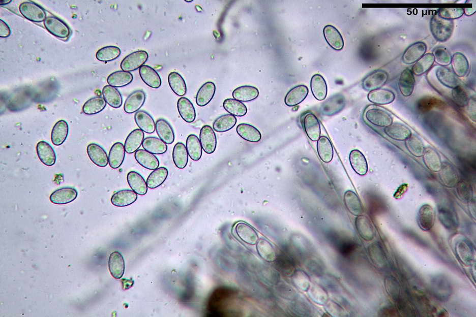 peziza subviolacea 4827 25.jpg