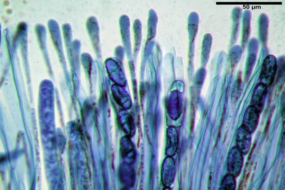 Scutellinia cejpii 060.jpg