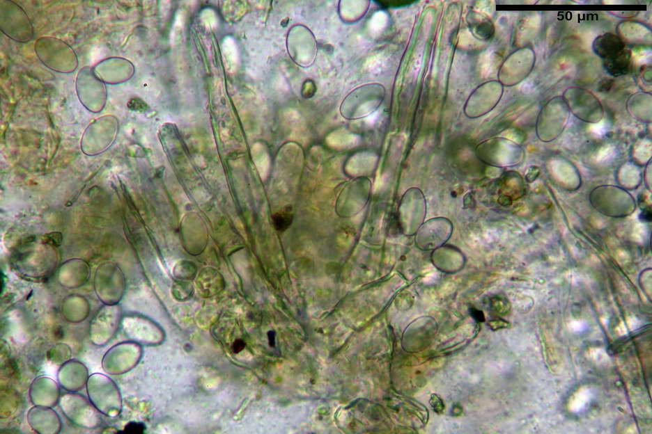 tricharina gilva 4831 18.jpg