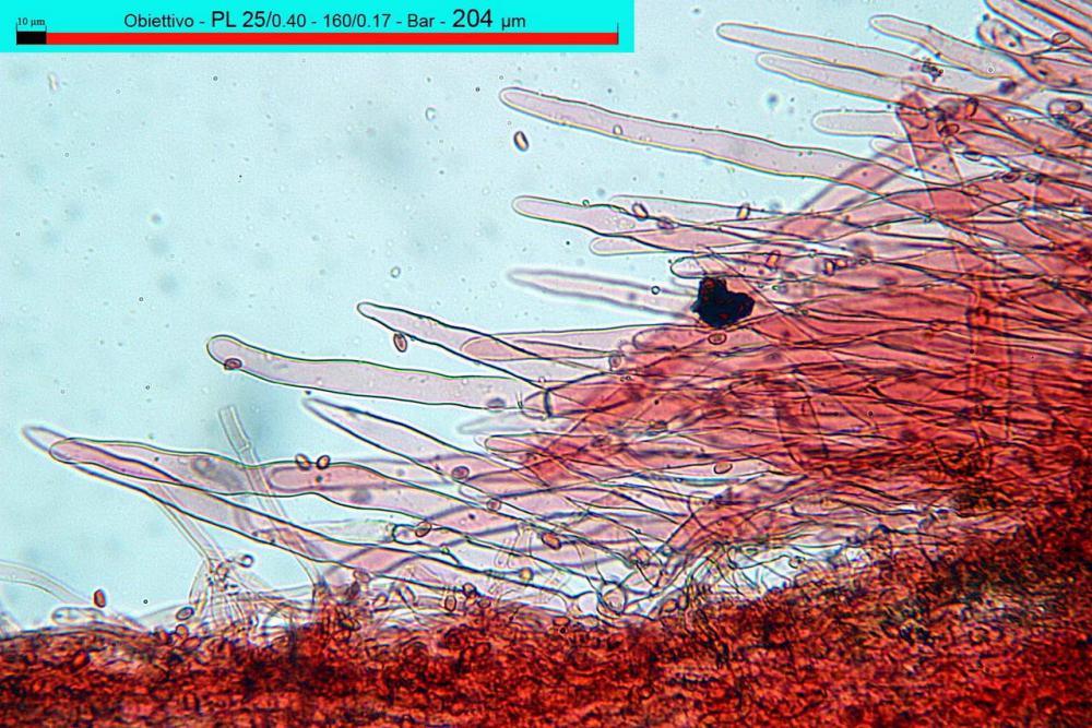 lepiota subincarnata pileipellis 03.JPG