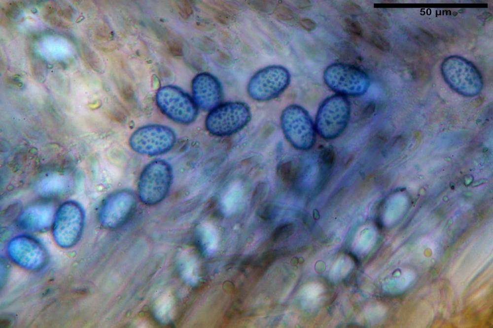 Scutellinia subhirtella 7482 49.jpg