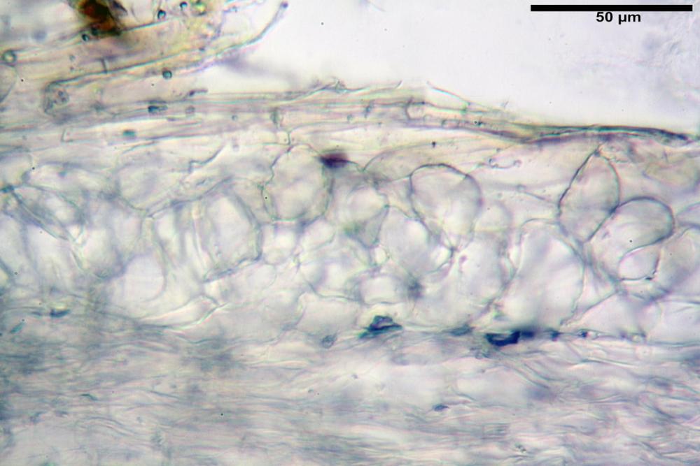 Cystoagaricus silvestris 5336 08.jpg