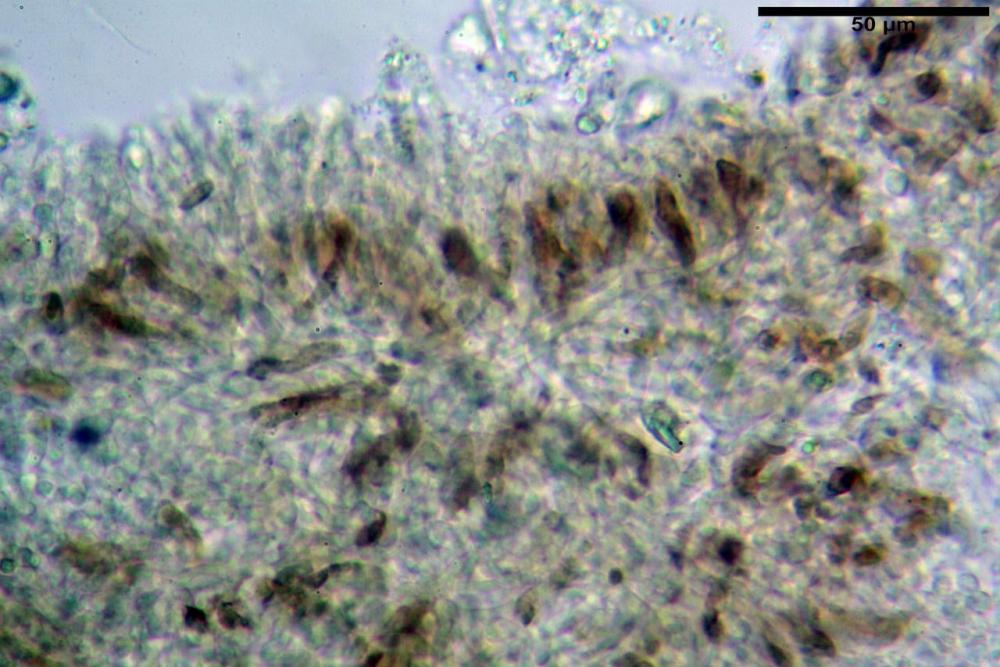 imenio luteo-olivaceum 6930 fresco KOH 30%.jpg