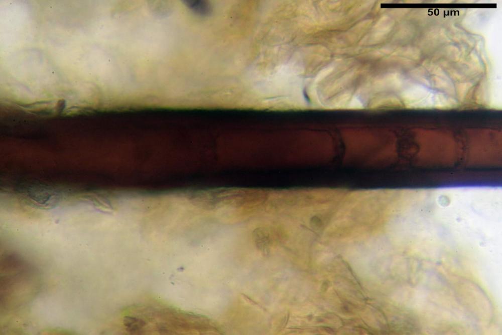 Scutellinia crinita 7493 29.jpg