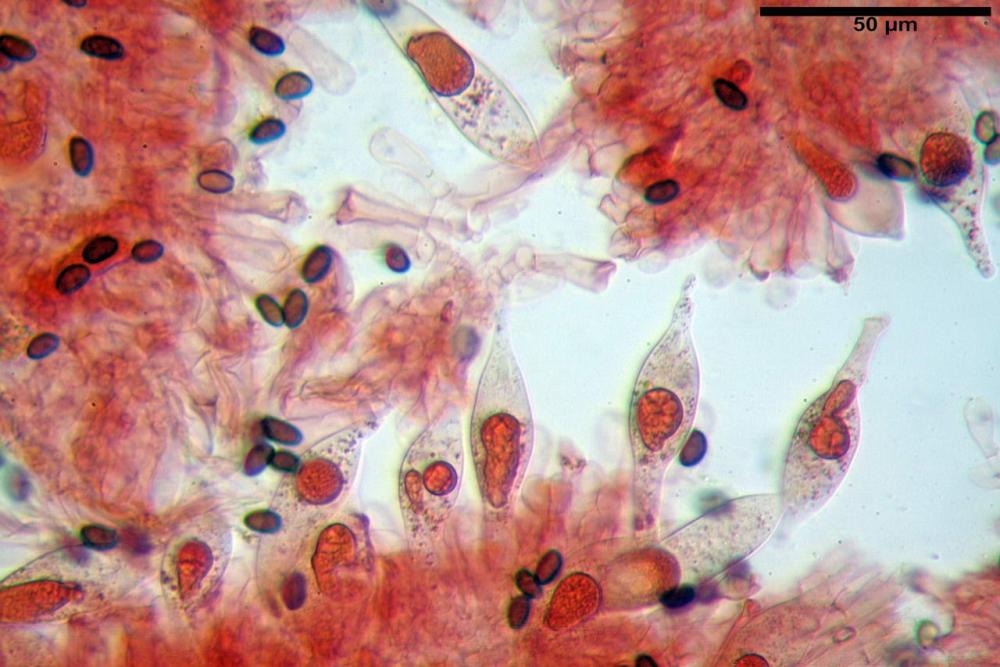 Cyclocybe cilindracea pleurocistidi 02.jpg