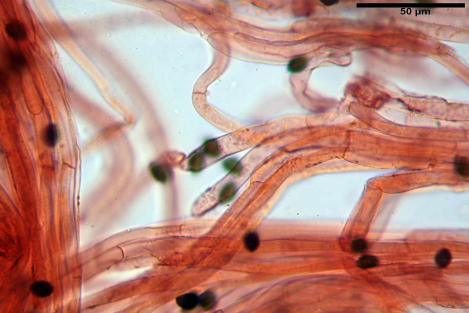lacrymaria pyrotricha 4812 85.jpg