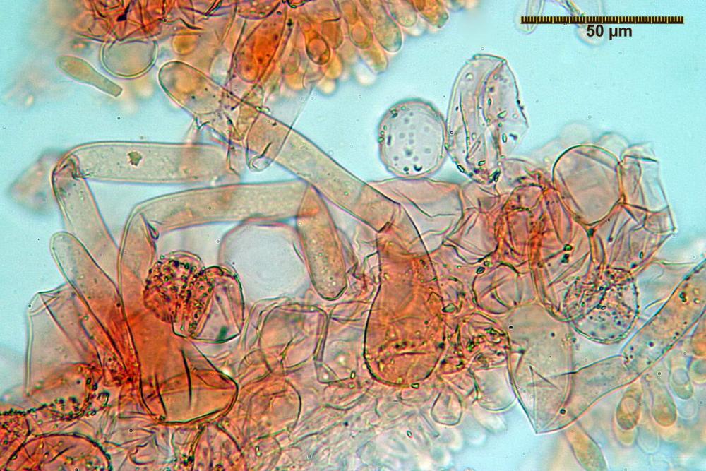 coprinellus disseminatus pileipellis pileocistidi velo.jpg