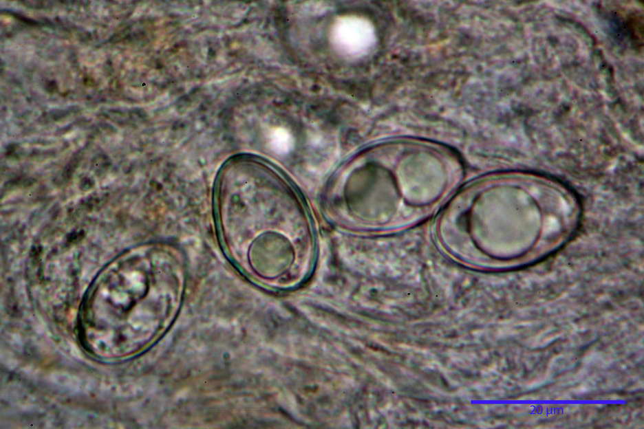 octospora roxheimii 4825 26.jpg