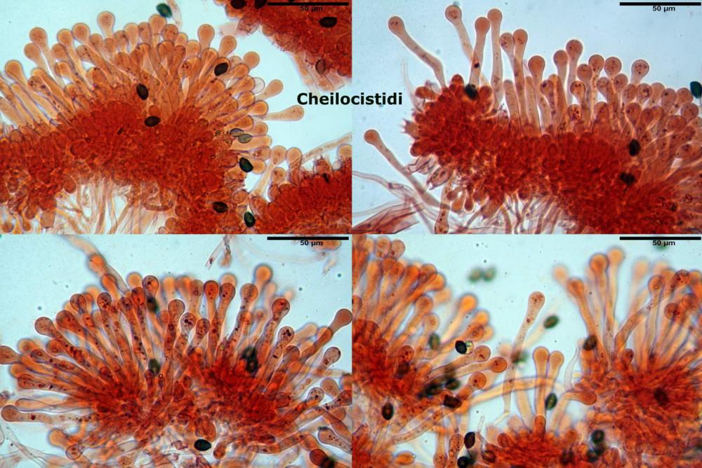 Lacrymaria lacrymabunda cheilocistidi.jpg