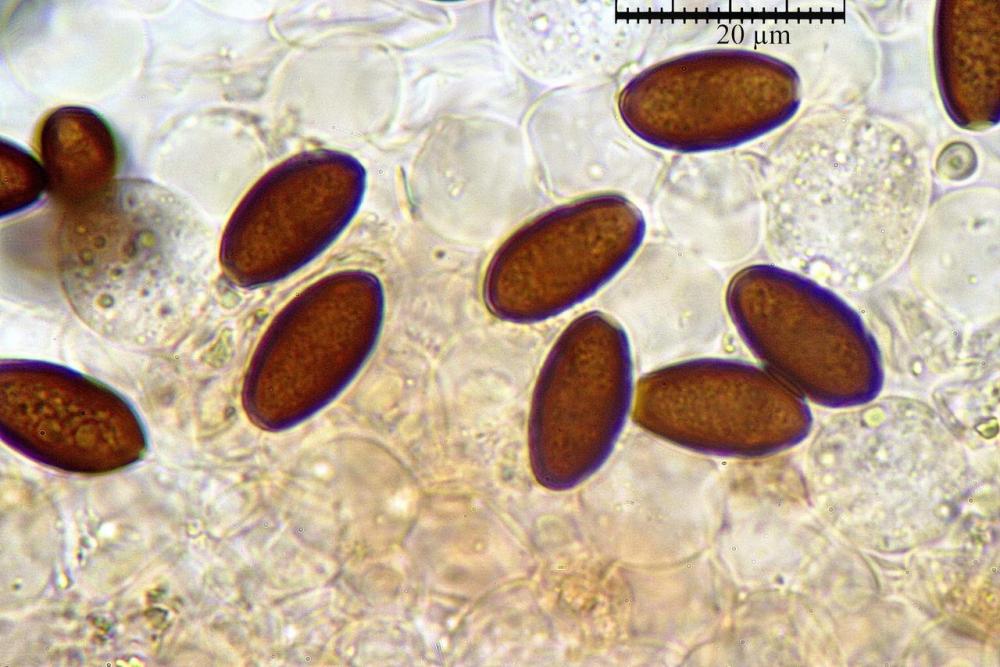 Parasola conopilus spore 07.jpg