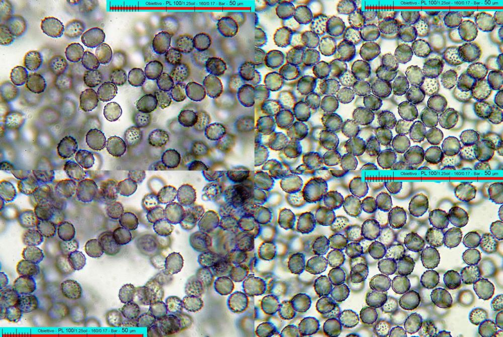 russula cyanoxantha spore profili.jpg