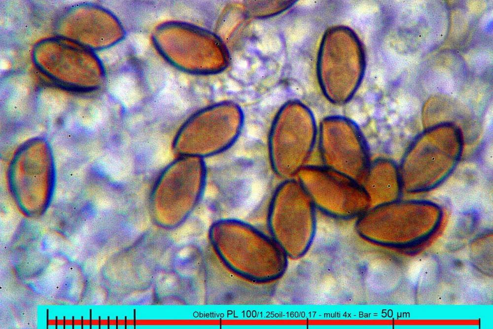 pholiotina aeruginosa Melzer spore 06.jpg