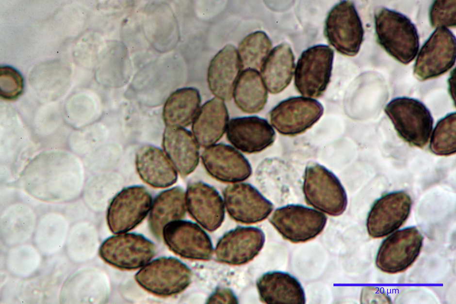 lacrymaria pyrotricha 4812 63.jpg