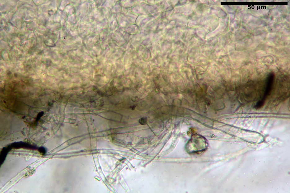 octospora roxheimii 4825 15.jpg