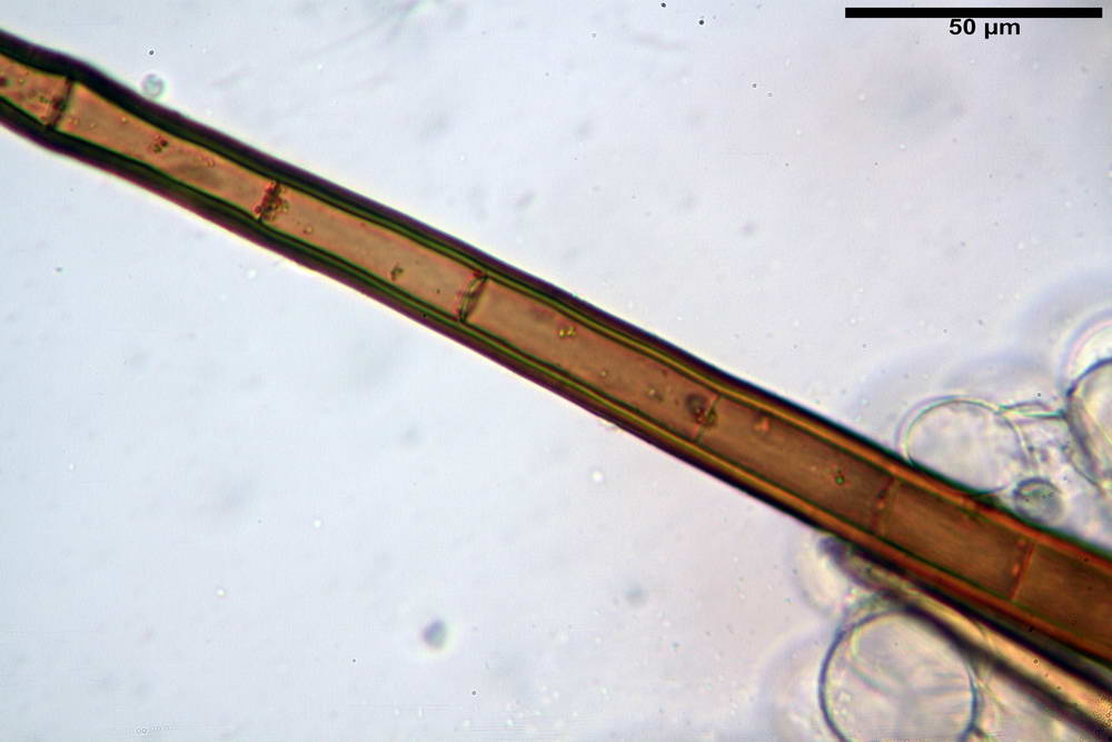 cheilimenia stercorea 4900 29.jpg