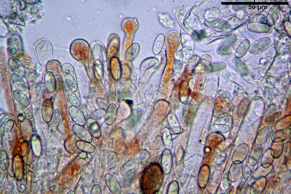 cheilimenia granulata 0015 .jpg