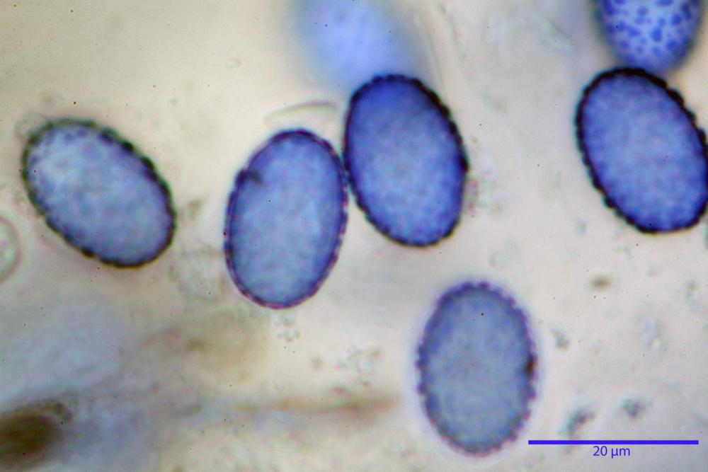 Scutellinia subhirtella 7482 56.jpg