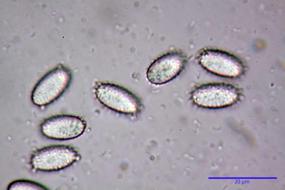 peziza echinospora 4826 64.jpg