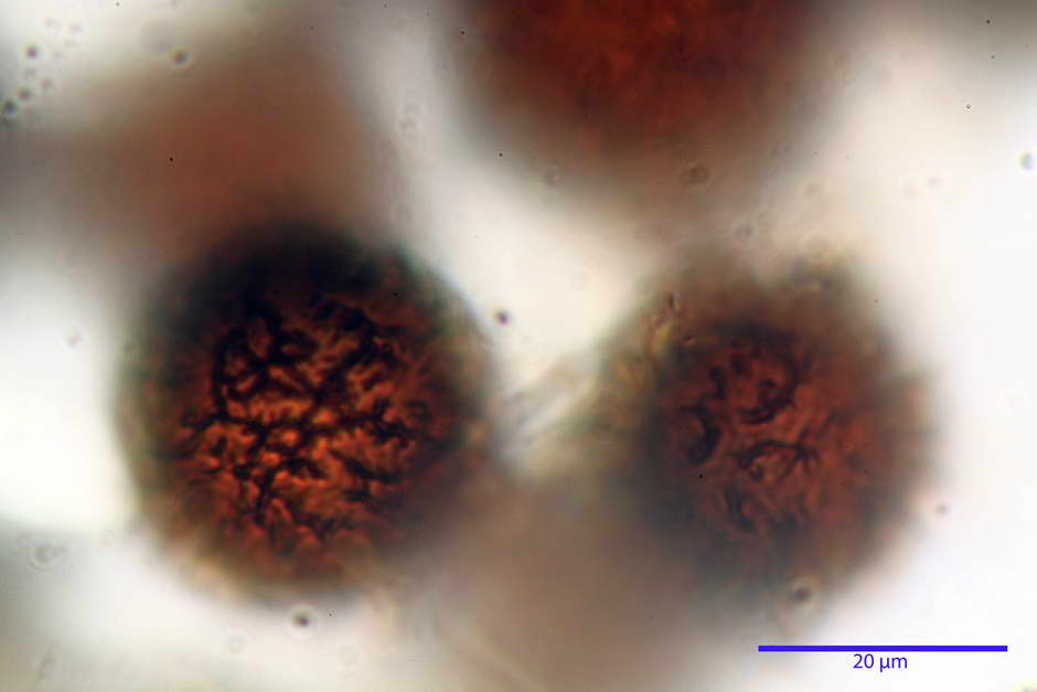 elaphomyces granulatus 4710 25.jpg