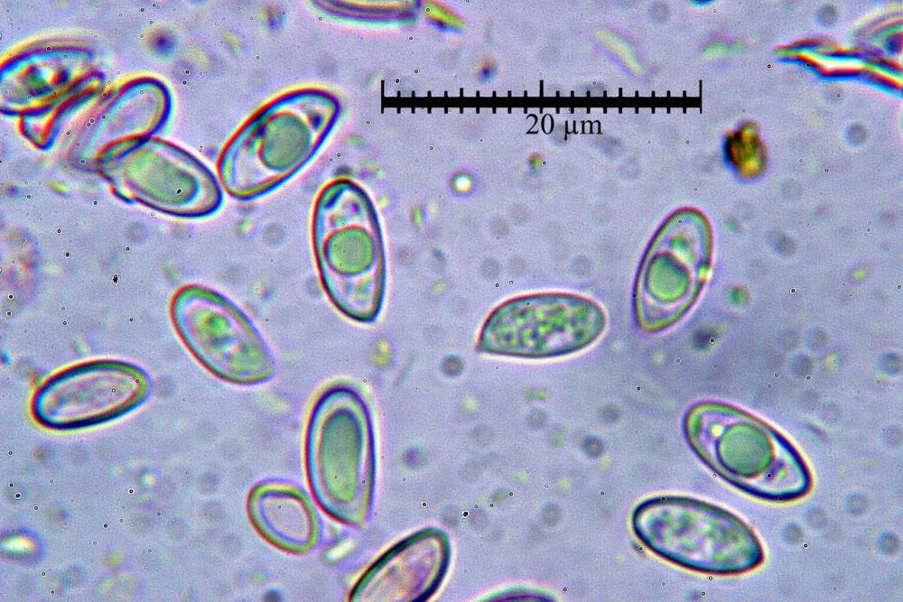 macrocystidia cucumis spore.jpg