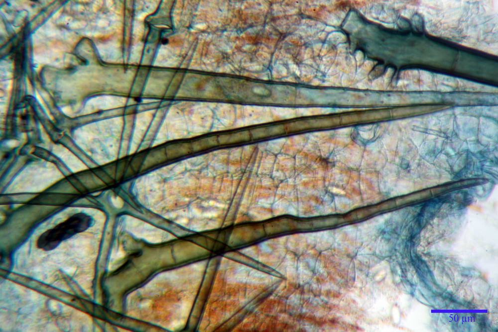 cheilimenia stercorea 4900 57.jpg